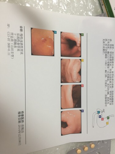 南微医学获得实用新型专利授权：“一种冷热套圈器及黏膜切除手术器械”