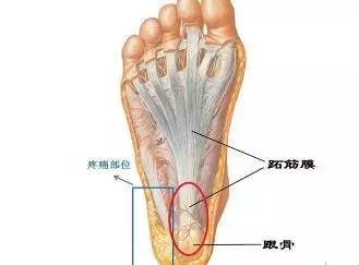 威高骨科获得发明专利授权：“一种用于跟骨置换的定制跟骨假体及制造方法”